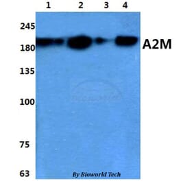Anti-A2M Antibody from Bioworld Technology (BS60859) - Antibodies.com