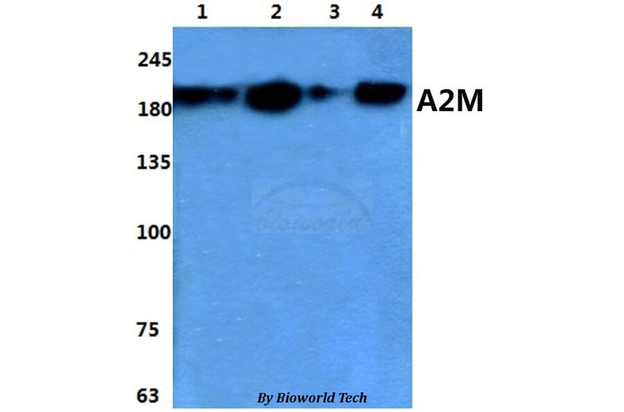 Anti-A2M Antibody from Bioworld Technology (BS60859) - Antibodies.com