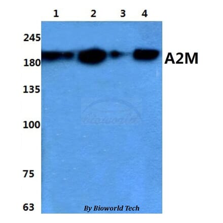 Anti-A2M Antibody from Bioworld Technology (BS60859) - Antibodies.com