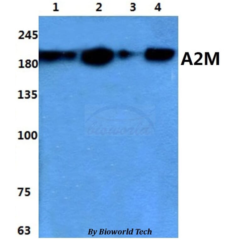 Anti-A2M Antibody from Bioworld Technology (BS60859) - Antibodies.com