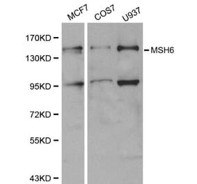 Anti-MSH6 Antibody from Bioworld Technology (BS6086) - Antibodies.com