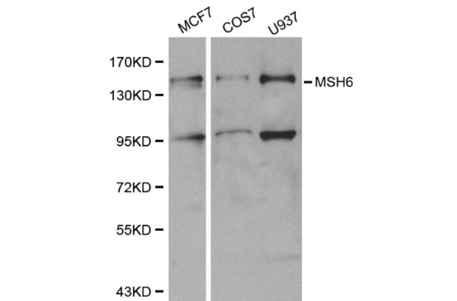 Anti-MSH6 Antibody from Bioworld Technology (BS6086) - Antibodies.com