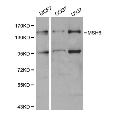 Anti-MSH6 Antibody from Bioworld Technology (BS6086) - Antibodies.com