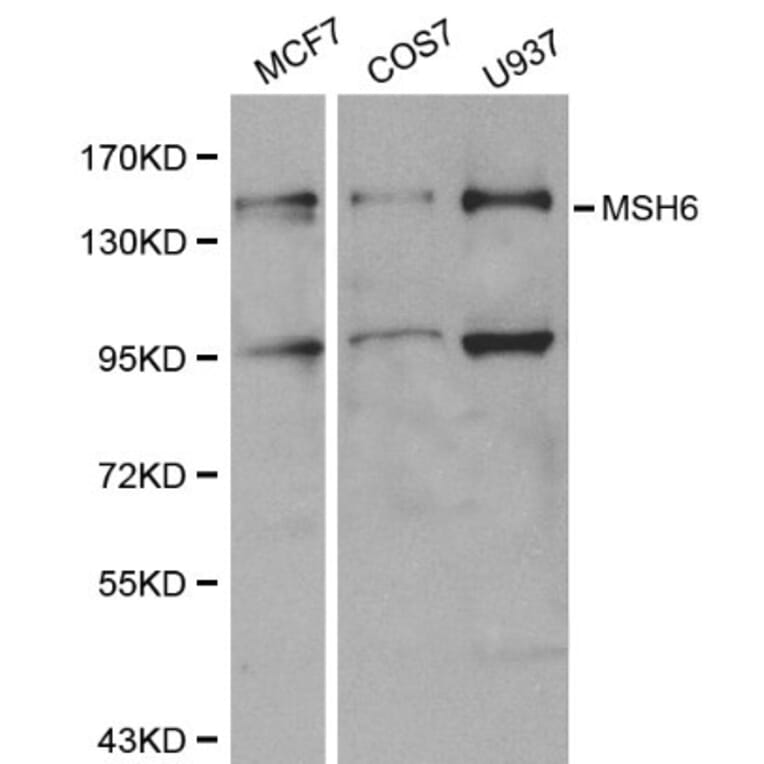 Anti-MSH6 Antibody from Bioworld Technology (BS6086) - Antibodies.com