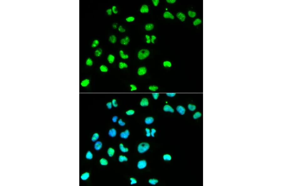 Anti-MSH6 Antibody from Bioworld Technology (BS6086) - Antibodies.com