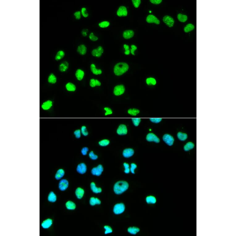 Anti-MSH6 Antibody from Bioworld Technology (BS6086) - Antibodies.com