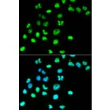 Anti-MSH6 Antibody from Bioworld Technology (BS6086) - Antibodies.com