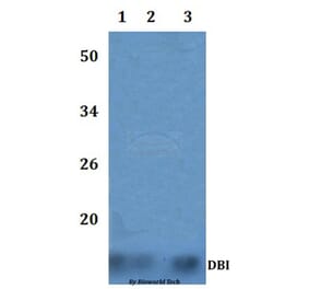 Anti-DBI Antibody from Bioworld Technology (BS60861) - Antibodies.com