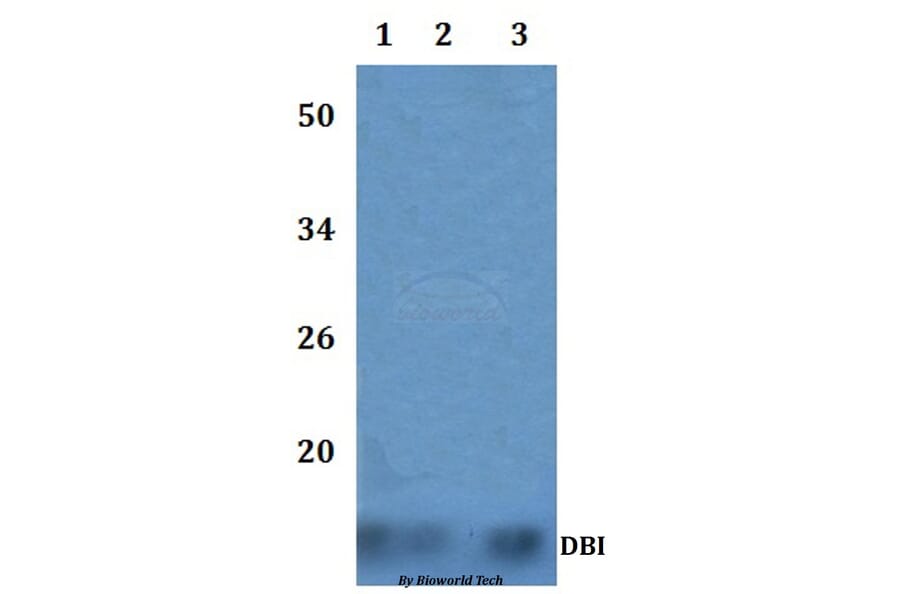 Anti-DBI Antibody from Bioworld Technology (BS60861) - Antibodies.com