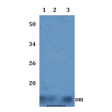 Anti-DBI Antibody from Bioworld Technology (BS60861) - Antibodies.com