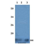 Anti-DBI Antibody from Bioworld Technology (BS60861) - Antibodies.com