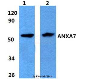 Anti-ANXA7 Antibody from Bioworld Technology (BS60862) - Antibodies.com