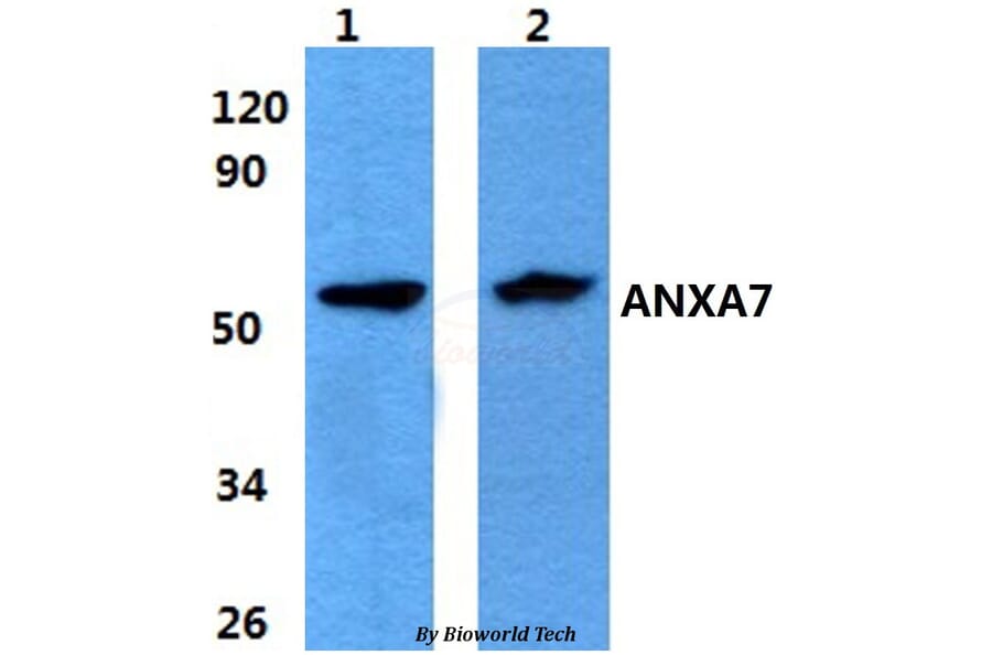 Anti-ANXA7 Antibody from Bioworld Technology (BS60862) - Antibodies.com