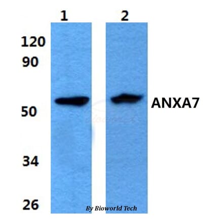 Anti-ANXA7 Antibody from Bioworld Technology (BS60862) - Antibodies.com