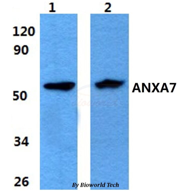 Anti-ANXA7 Antibody from Bioworld Technology (BS60862) - Antibodies.com