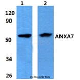 Anti-ANXA7 Antibody from Bioworld Technology (BS60862) - Antibodies.com