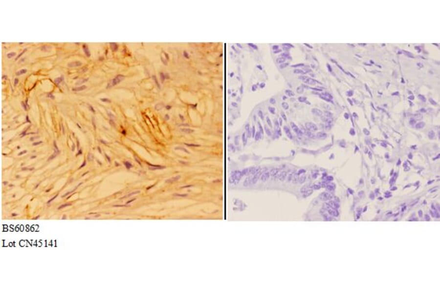 Anti-ANXA7 Antibody from Bioworld Technology (BS60862) - Antibodies.com