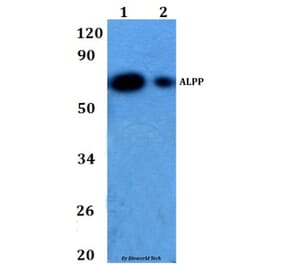 Anti-ALPP Antibody from Bioworld Technology (BS60863) - Antibodies.com