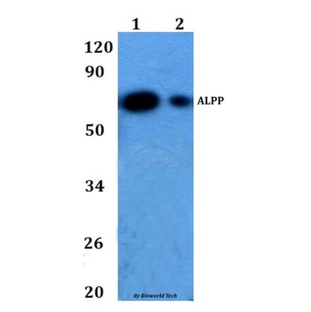 Anti-ALPP Antibody from Bioworld Technology (BS60863) - Antibodies.com