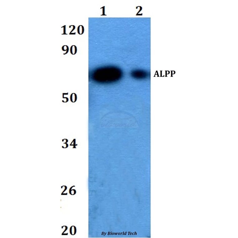 Anti-ALPP Antibody from Bioworld Technology (BS60863) - Antibodies.com