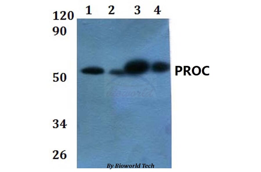 Anti-PROC Antibody from Bioworld Technology (BS60875) - Antibodies.com