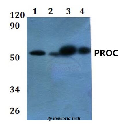 Anti-PROC Antibody from Bioworld Technology (BS60875) - Antibodies.com