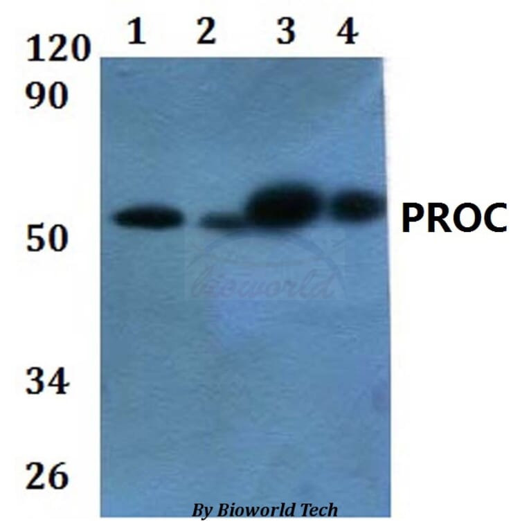 Anti-PROC Antibody from Bioworld Technology (BS60875) - Antibodies.com