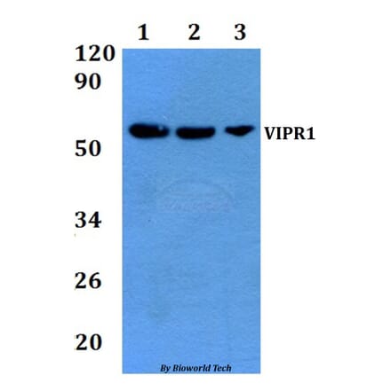 Anti-VIPR1 Antibody from Bioworld Technology (BS60880) - Antibodies.com