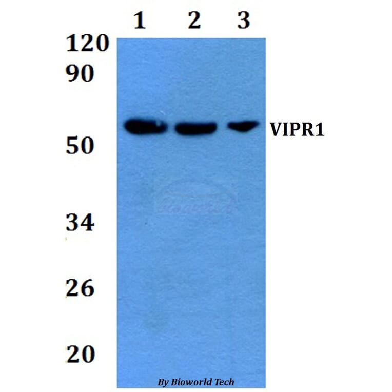 Anti-VIPR1 Antibody from Bioworld Technology (BS60880) - Antibodies.com