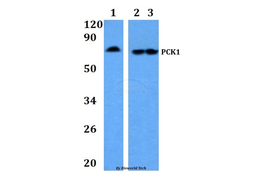 Anti-PCK1 Antibody from Bioworld Technology (BS60887) - Antibodies.com