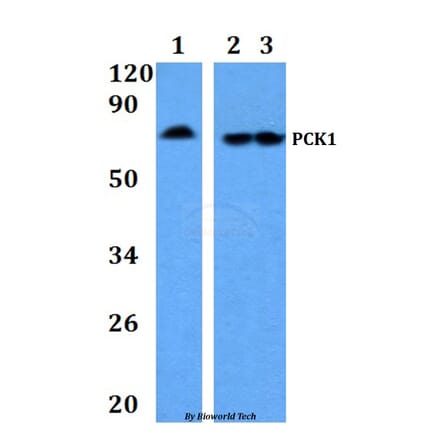 Anti-PCK1 Antibody from Bioworld Technology (BS60887) - Antibodies.com
