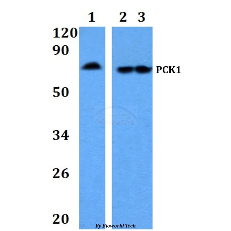 Anti-PCK1 Antibody from Bioworld Technology (BS60887) - Antibodies.com