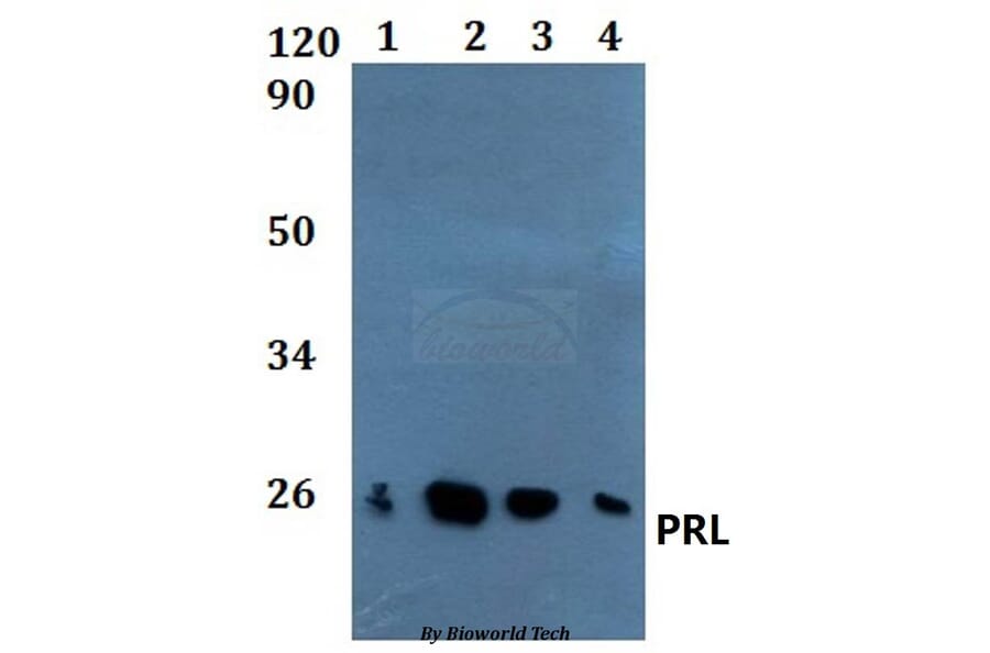 Anti-PRL Antibody from Bioworld Technology (BS60888) - Antibodies.com
