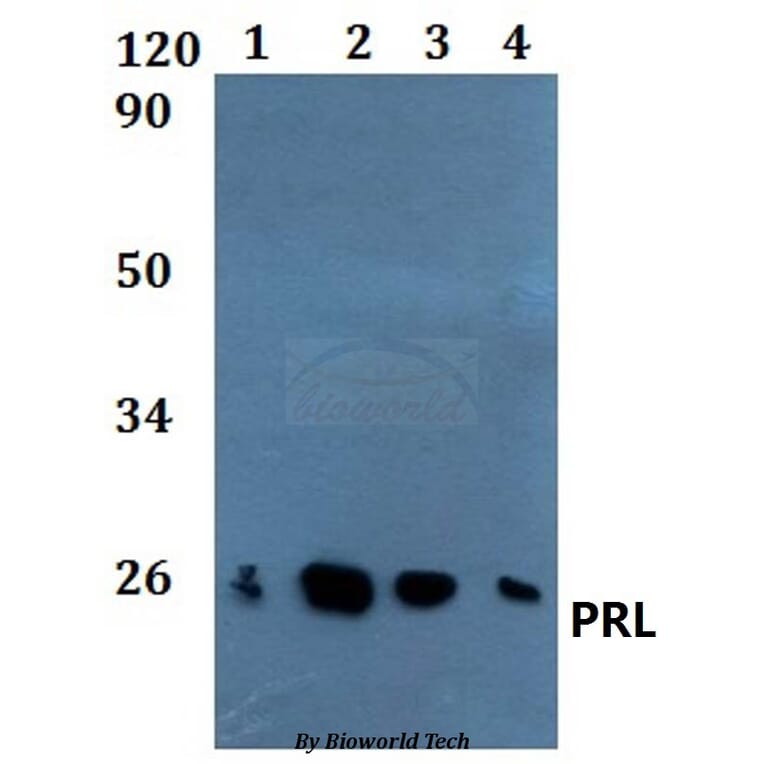 Anti-PRL Antibody from Bioworld Technology (BS60888) - Antibodies.com