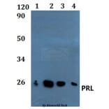 Anti-PRL Antibody from Bioworld Technology (BS60888) - Antibodies.com