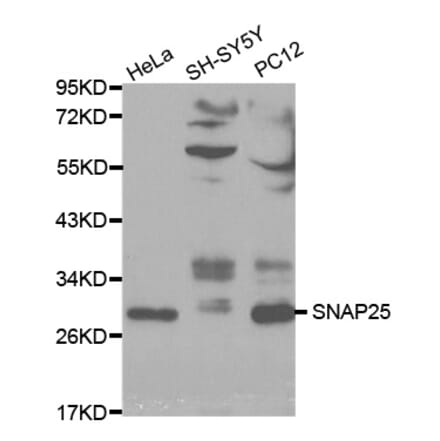 Anti-SNAP25 Antibody from Bioworld Technology (BS6089) - Antibodies.com