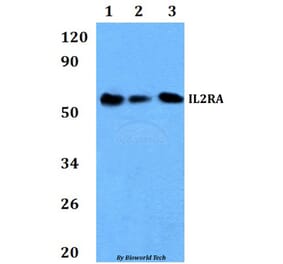 Anti-IL2RA Antibody from Bioworld Technology (BS60896) - Antibodies.com