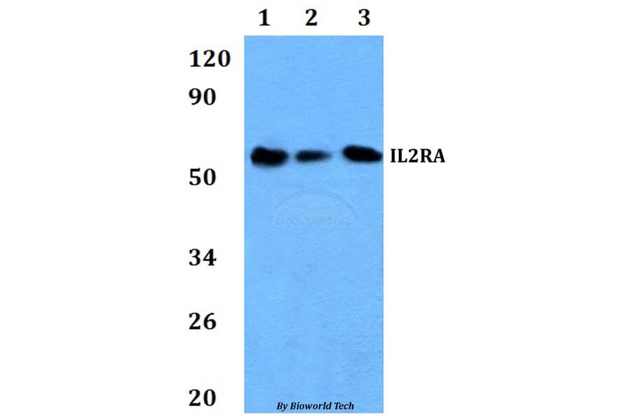 Anti-IL2RA Antibody from Bioworld Technology (BS60896) - Antibodies.com
