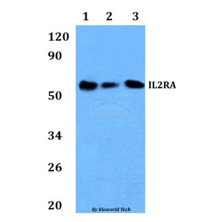 Anti-IL2RA Antibody from Bioworld Technology (BS60896) - Antibodies.com