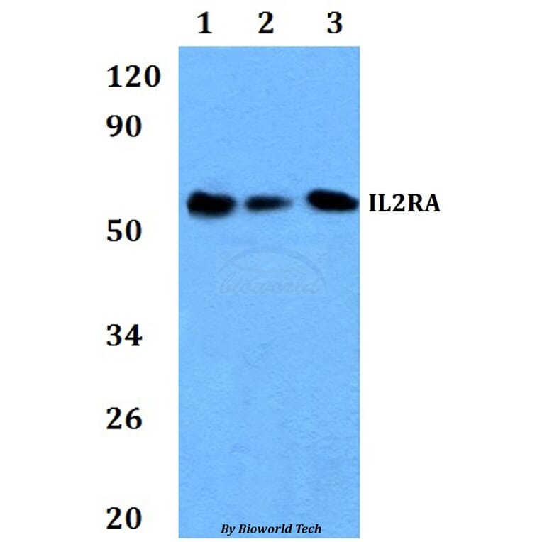 Anti-IL2RA Antibody from Bioworld Technology (BS60896) - Antibodies.com