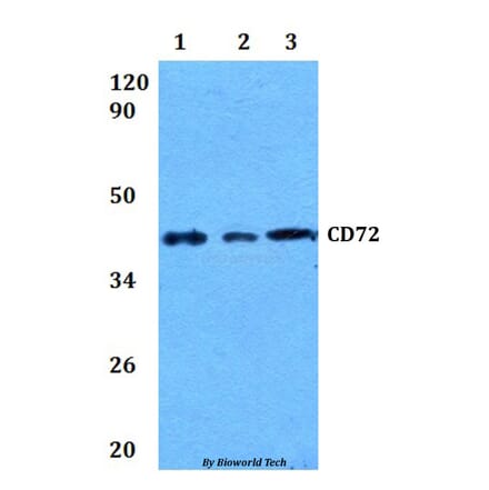 Anti-CD72 Antibody from Bioworld Technology (BS60905) - Antibodies.com