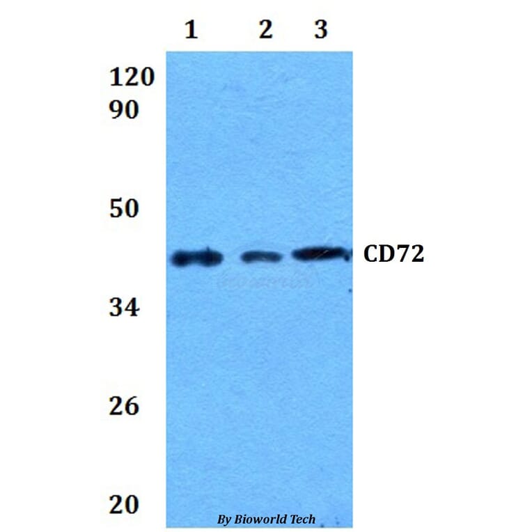 Anti-CD72 Antibody from Bioworld Technology (BS60905) - Antibodies.com