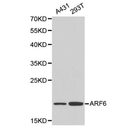 Anti-ARF6 Antibody from Bioworld Technology (BS6092) - Antibodies.com