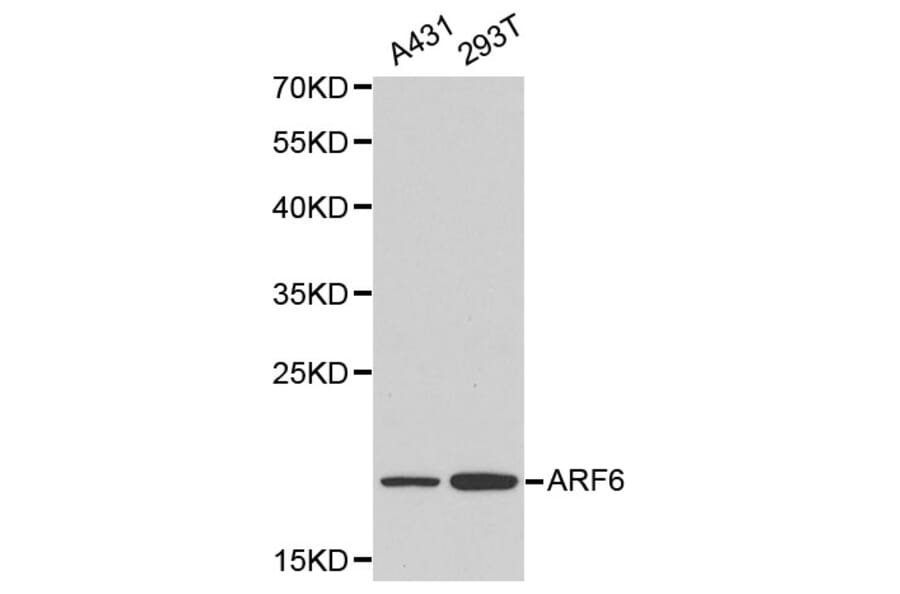 Anti-ARF6 Antibody from Bioworld Technology (BS6092) - Antibodies.com