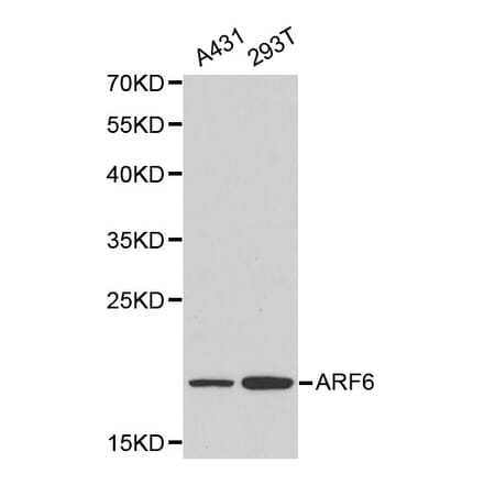Anti-ARF6 Antibody from Bioworld Technology (BS6092) - Antibodies.com