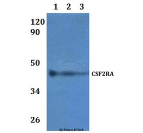 Anti-CSF2RA Antibody from Bioworld Technology (BS60920) - Antibodies.com