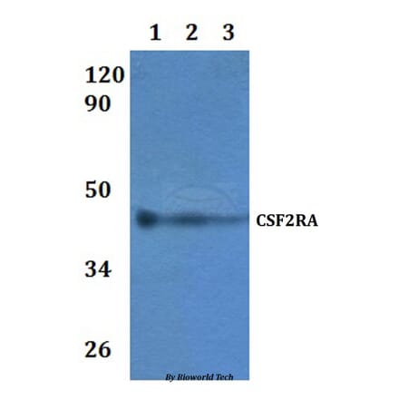 Anti-CSF2RA Antibody from Bioworld Technology (BS60920) - Antibodies.com