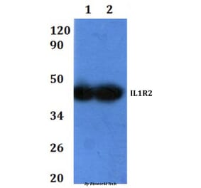 Anti-IL1R2 Antibody from Bioworld Technology (BS60921) - Antibodies.com