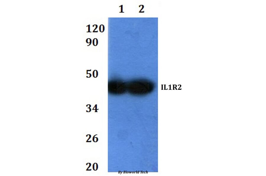 Anti-IL1R2 Antibody from Bioworld Technology (BS60921) - Antibodies.com
