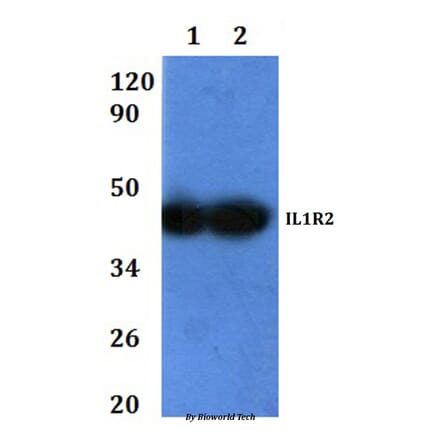 Anti-IL1R2 Antibody from Bioworld Technology (BS60921) - Antibodies.com